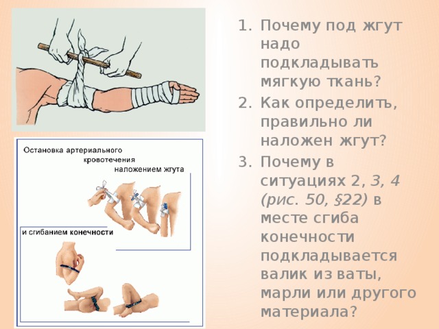 Почему под жгут надо подкладывать мягкую ткань? Как определить, правильно ли наложен жгут? Почему в ситуациях 2, 3, 4 (рис. 50, §22) в месте сгиба конечности подкладывает­ся валик из ваты, марли или другого материала?